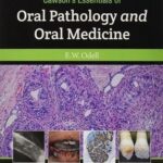 Cawson?s Essentials of Oral Pathology and Oral Medicine 9th Edition