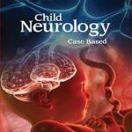 Child Neurology Case Based by Muhammad Saeed