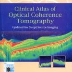 Clinical Atlas of Optical Coherence Tomography