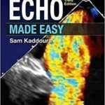 Echo Made Easy
