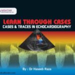 Learn Through Cases & Traces in Echocardiography