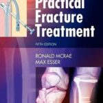 Practical Fracture Treatment