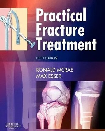 Practical Fracture Treatment