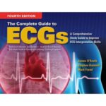 The Complete Guide to ECGs 4th Edition
